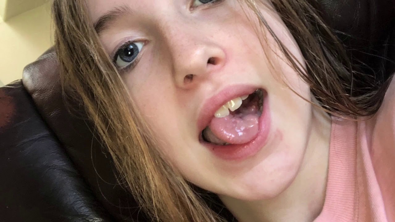 braces girl blowjob - femdomempire porn rachel steele stepmom