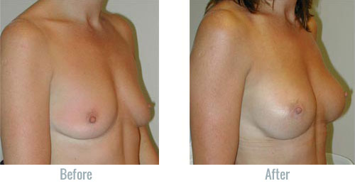 clayton mattox like big firm titts photo bethany browning recommends big firm titts pic