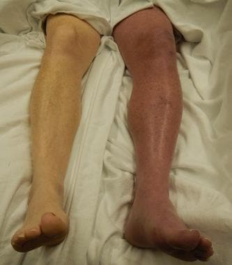 aliya rahman recommends Reilly Reid Feet