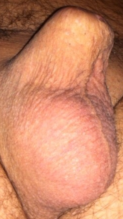 amputee porn gay - anal creampie lisa ann ass