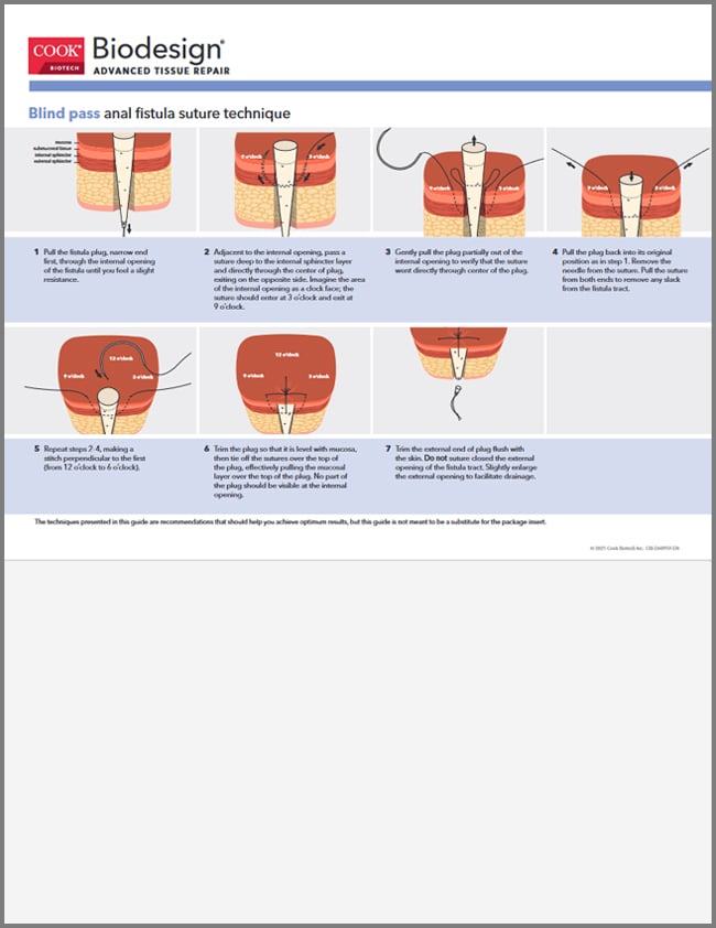 Best of andrew andraos's gallery bbw dp alexander schaper add photo anal fist guide