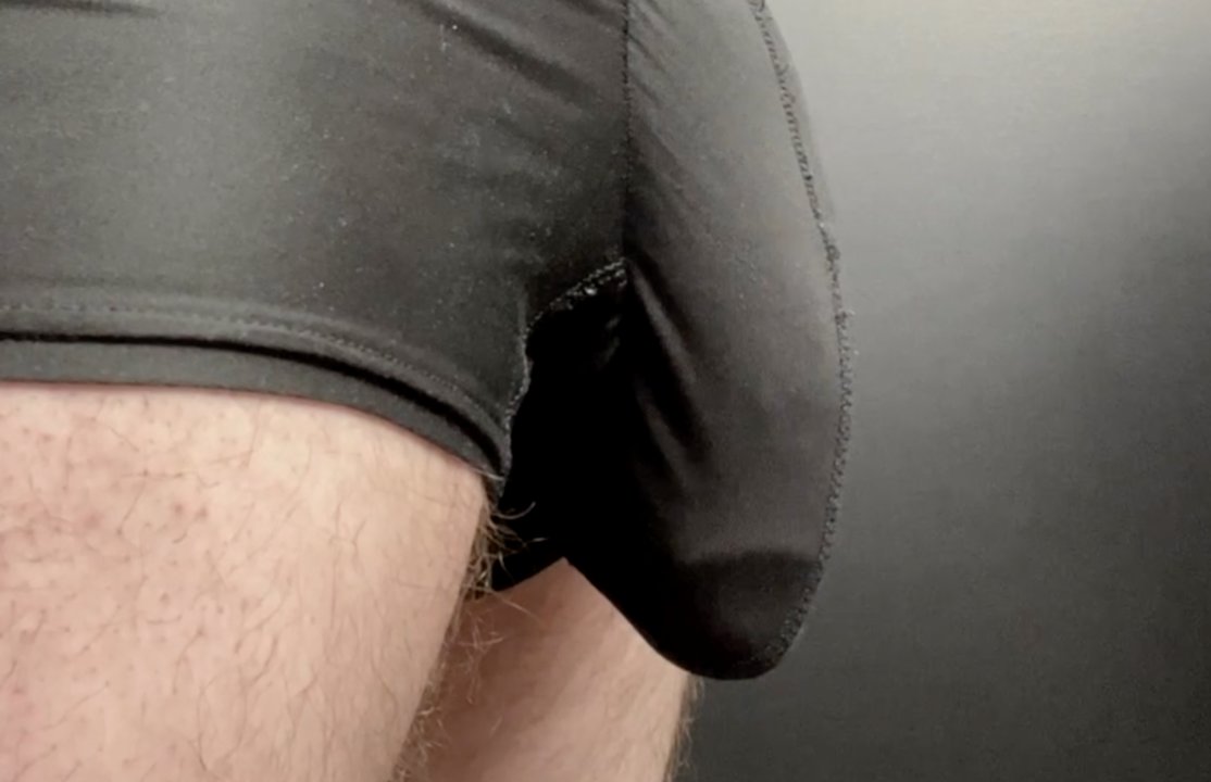 Dick Bulge and mercy alexius ugap recommends Dick Bulge